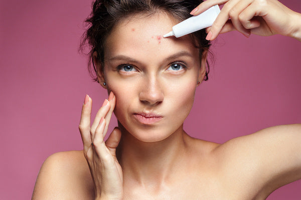 Navigating Acne-Friendly Products for Clearer Skin