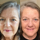 A woman displays a before-and-after comparison showing the effects of using forehead and between-the-eyes patches. The ‘before’ photo shows visible wrinkles, while the ‘after’ photo shows a smoother, more relaxed appearance, illustrating the patches' effectiveness.