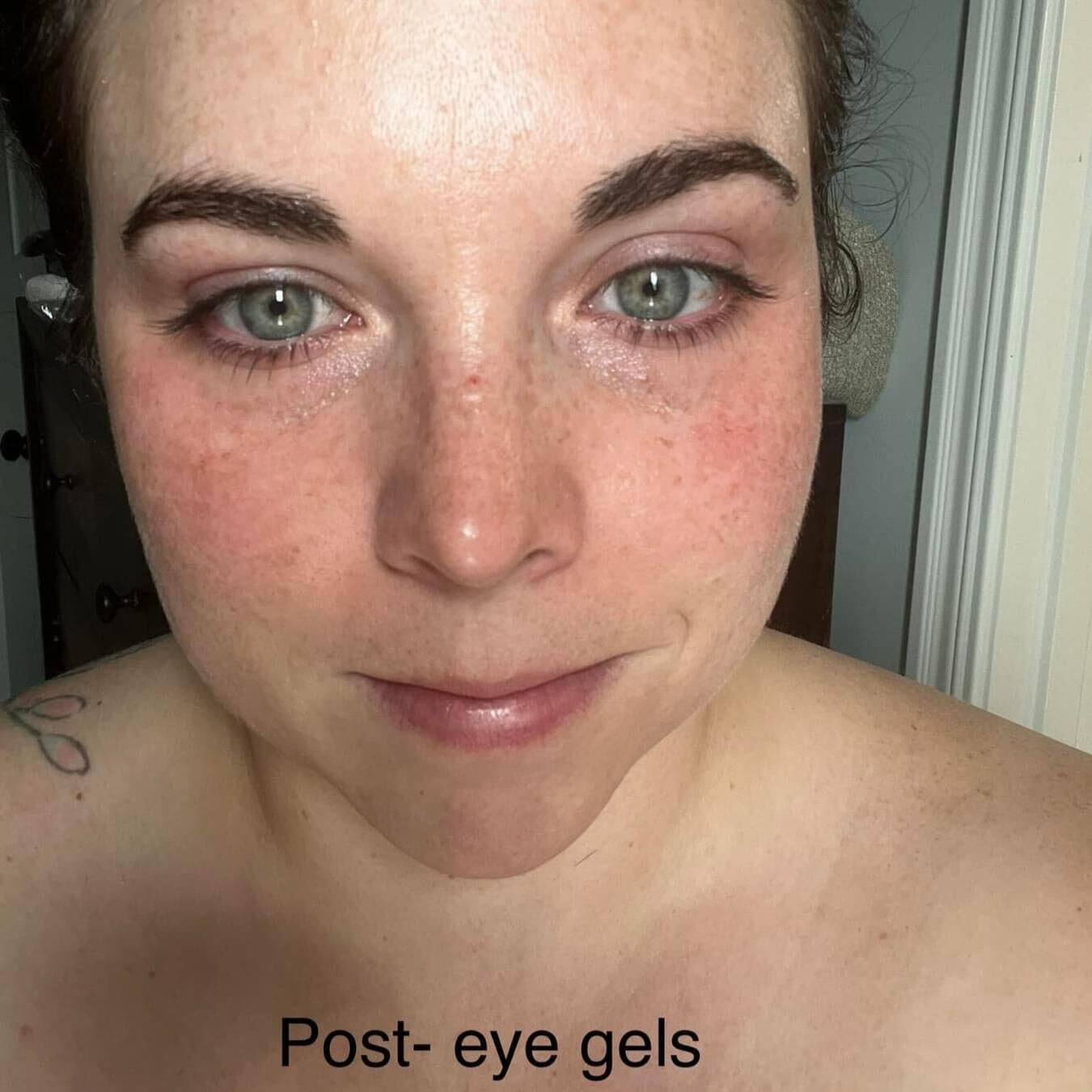 A customer showing her post using the Frownies under eye gels. Showing her results and dark circles lightning 