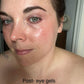 A customer showing her post using the Frownies under eye gels. Showing her results and dark circles lightning 