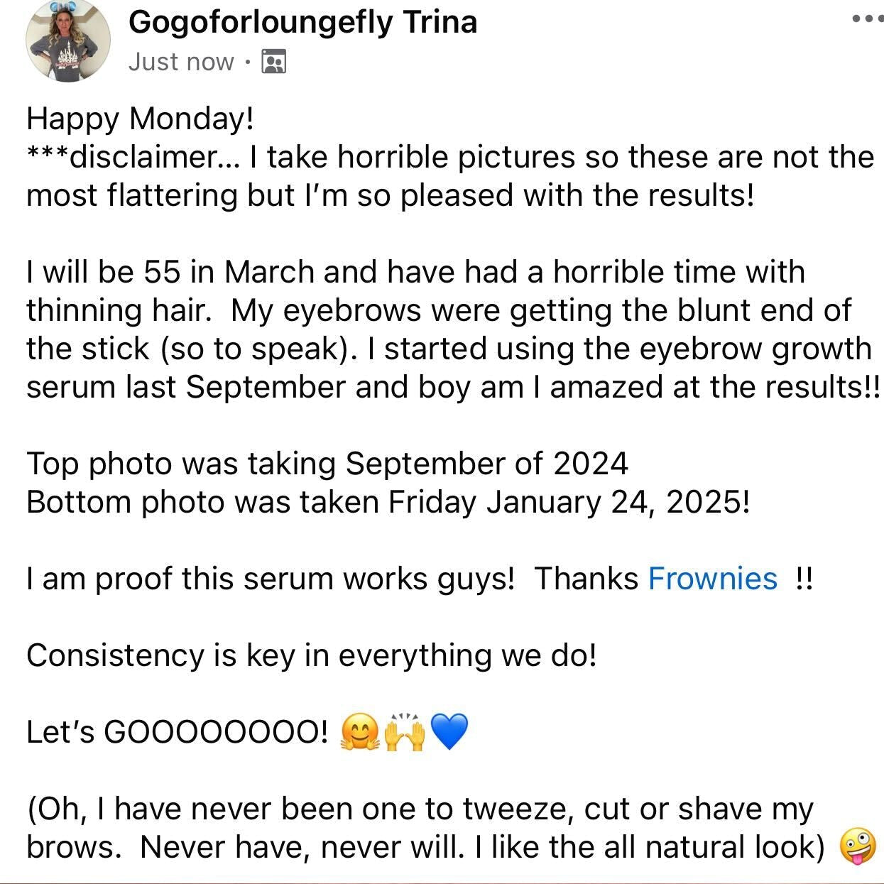 A Frownies customer testimonial for Frownies brow serum