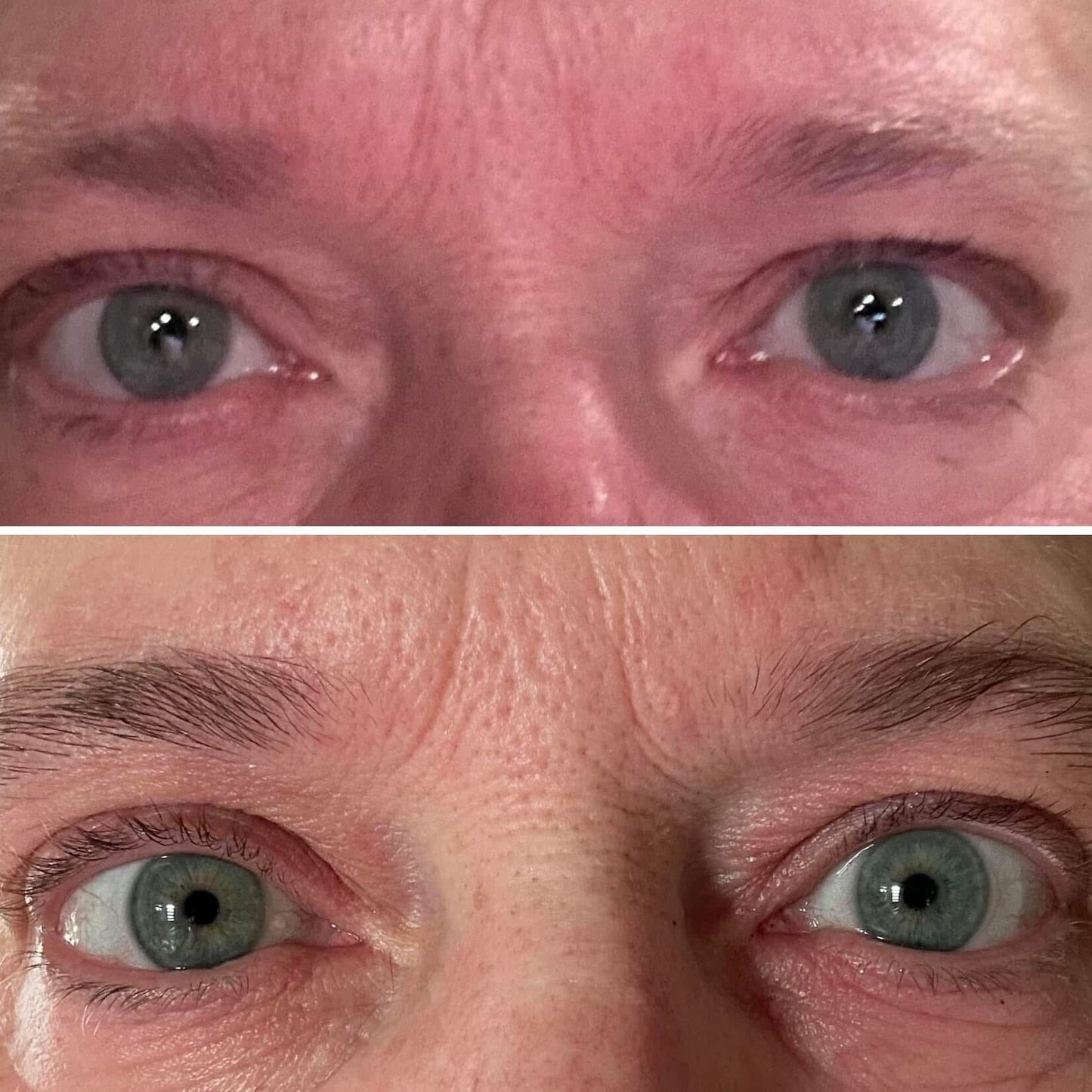 before and after of lash serum shows more full eyebrows with consistent use 