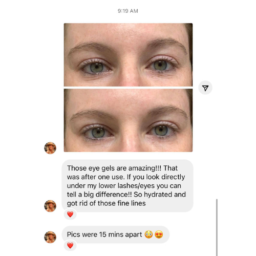 Before-and-after photo of a woman using Frownies Under Eye Gels. The 'before' image shows visible fine lines below her eyes, while the 'after' image shows a reduction in these lines. The image also includes a text thread review from her, stating that the eye gels worked, left her feeling refreshed, and helped reduce some fine lines below her eyes.